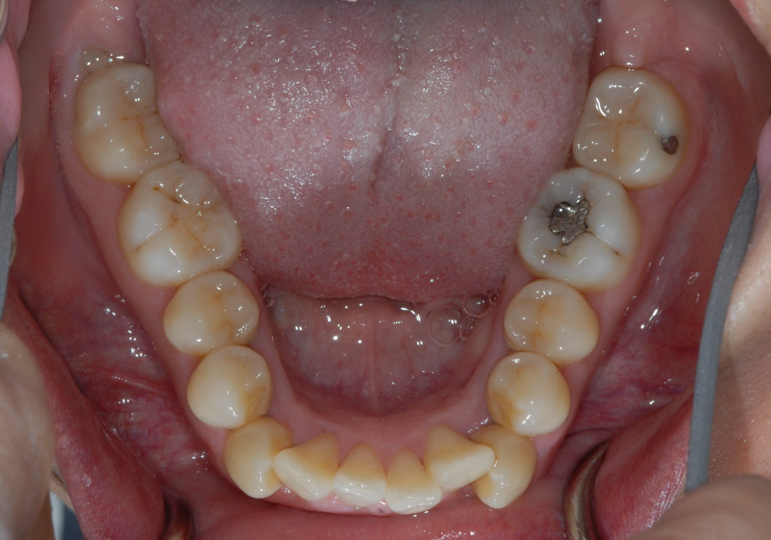 Before Image of dental work