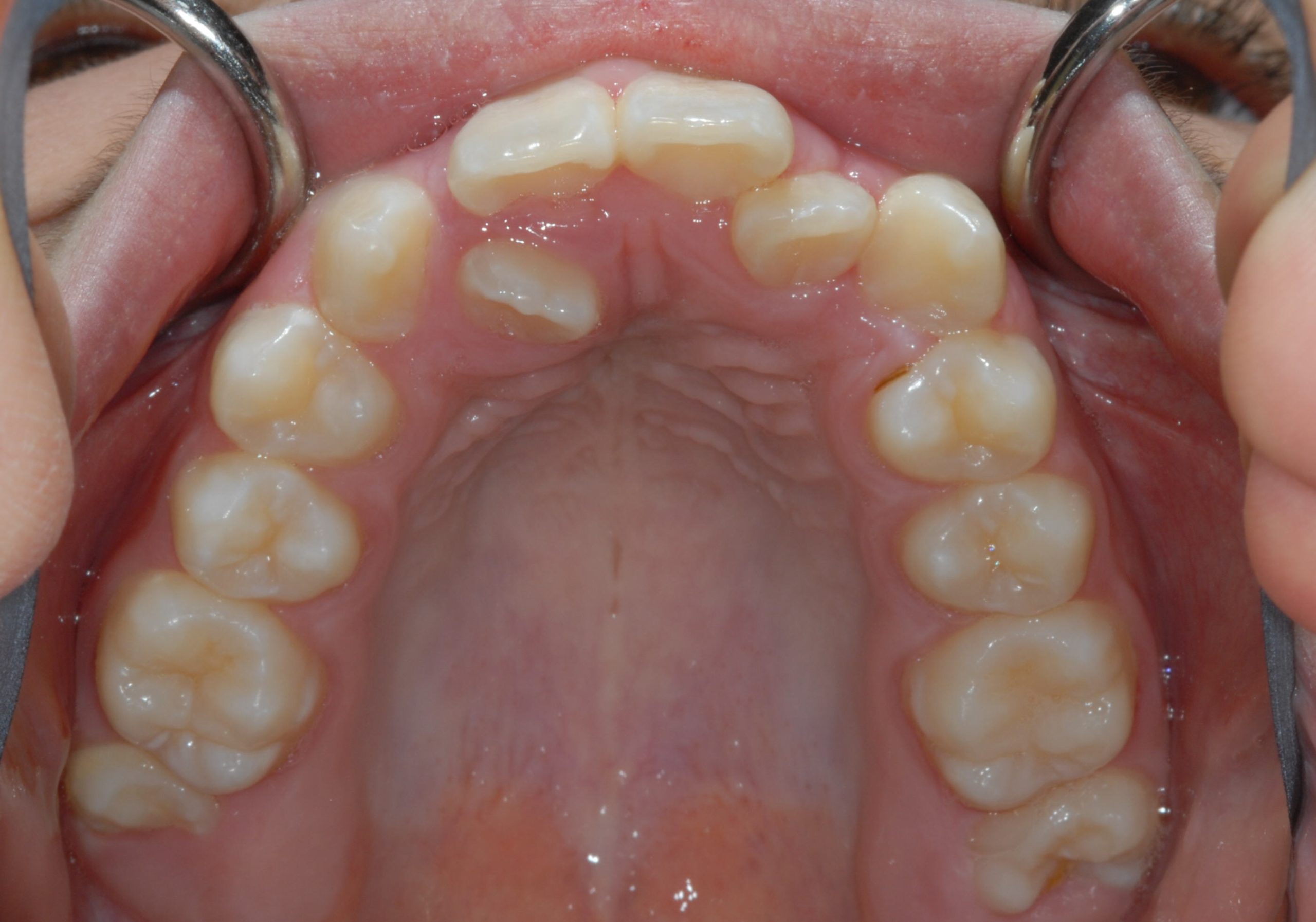 Before Image of dental work